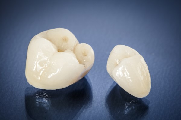 How Dental Crowns Affect Your Smile